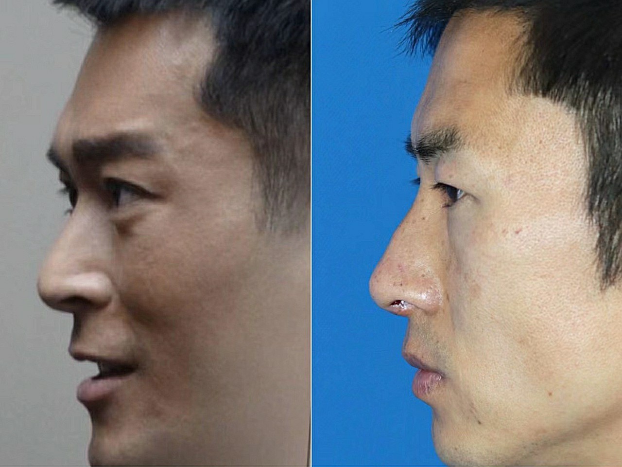 鼻大脸风水堂:鼻子和脸的面相特征